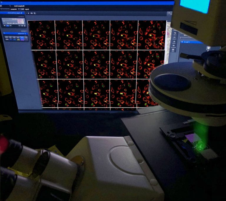 Spinning Disk Confocal Microscopy