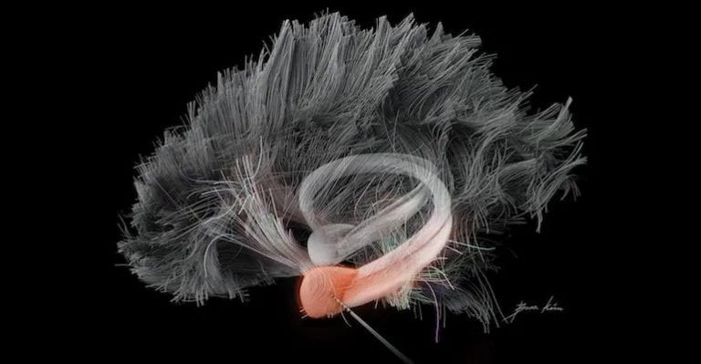 Stimulating the Amygdala Can Enhance Human Memory, Neuroscientists Say
